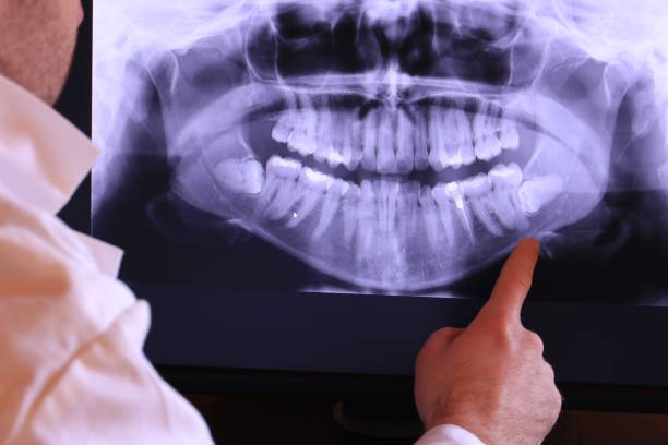 Best Emergency Tooth Extraction in Watkinsville, GA